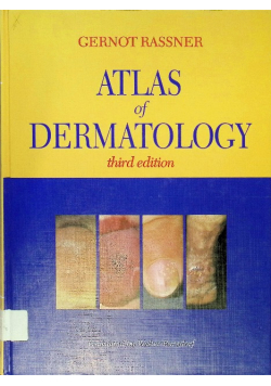 Atlas of Dermatology