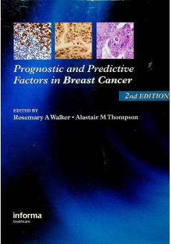 Prognostic and Predictive Factors in Breast Cancer