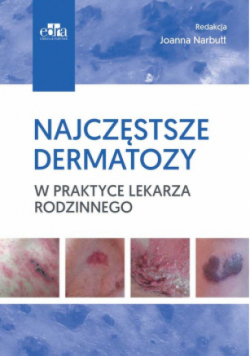 Najczęstsze dermatozy w praktyce lekarza rodzinnego