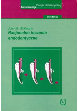 Racjonalne leczenie endodontyczne