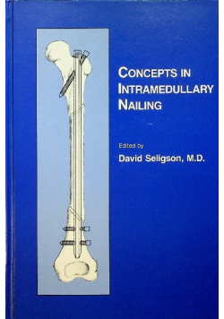 Concepts in Intramedullary Nailing