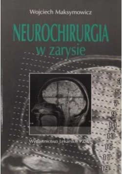 Neurochirurgia w zarysie