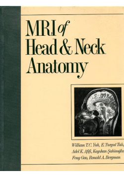 MRI of Head and Neck Anatomy