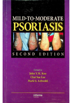 Mild-to-Moderate Psoriasis Second Edition
