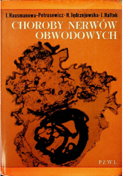 Choroby nerwów obwodowych